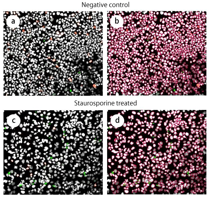 图1高密度HepG2文化与核聚合图像