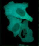 实时/实时FRET成像